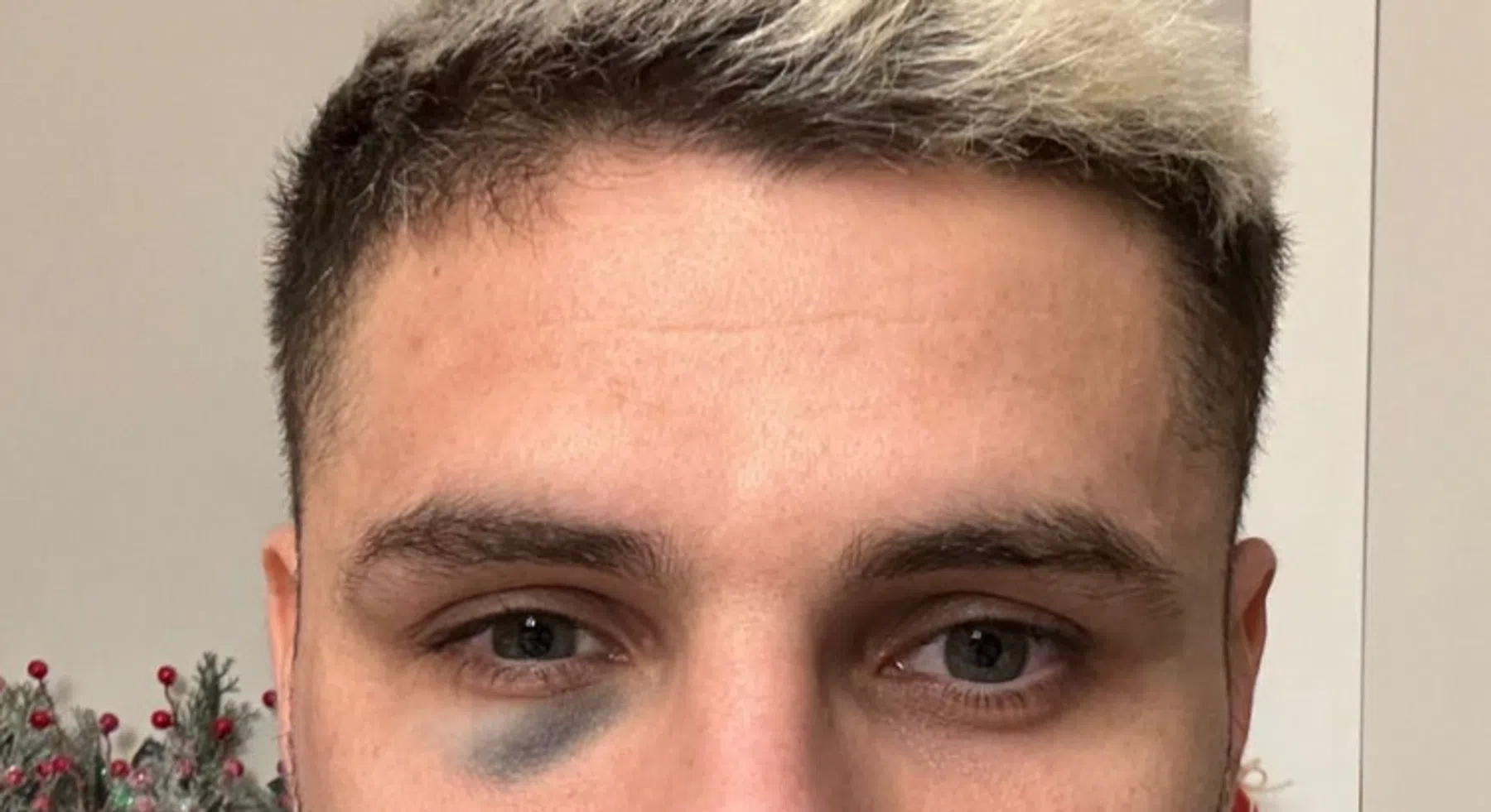 Dit is het verhaal achter het blauwe oog van Icardi