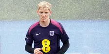 Thumbnail for article: Door dit bijzondere voorval heeft Engeland-aanvaller Gordon een wond op zijn kin